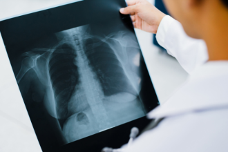 Dra. Thaline Neves destaca a importância da radiologia pediátrica com foco em segurança, precisão e cuidado infantil.